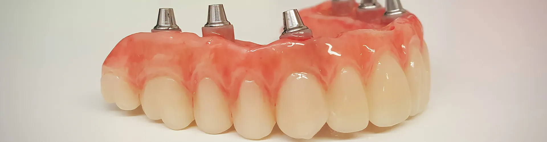 Upper denture.