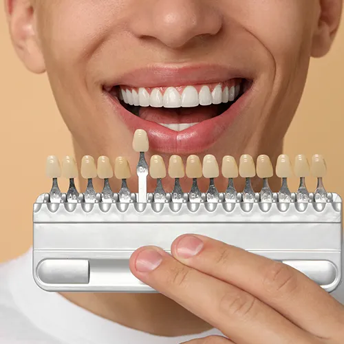 man holding tooth shade-matching tool against his smile