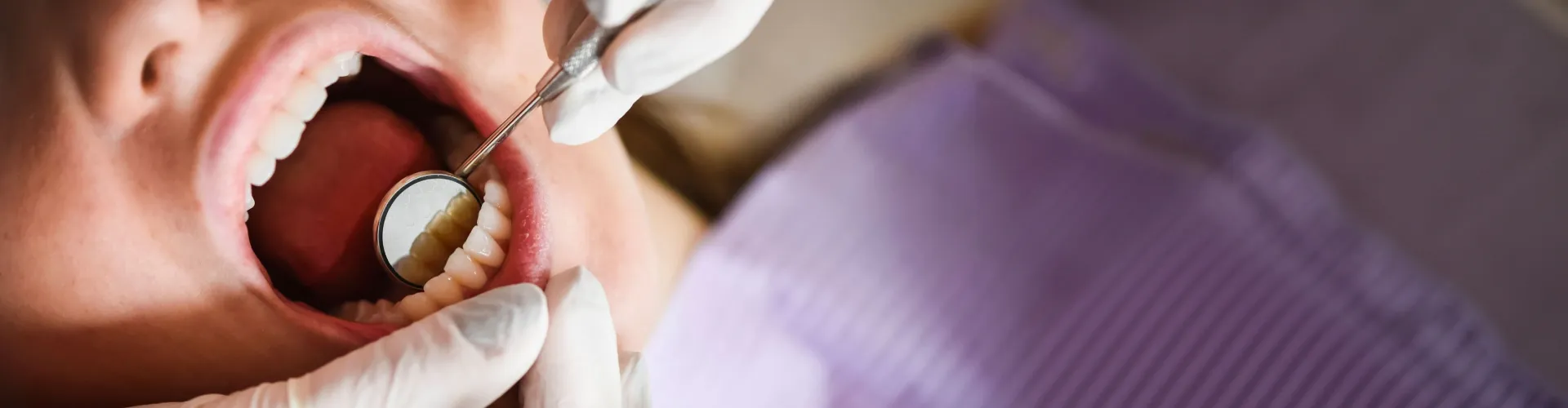 Gloved hands holding dental mirror in patient's mouth.