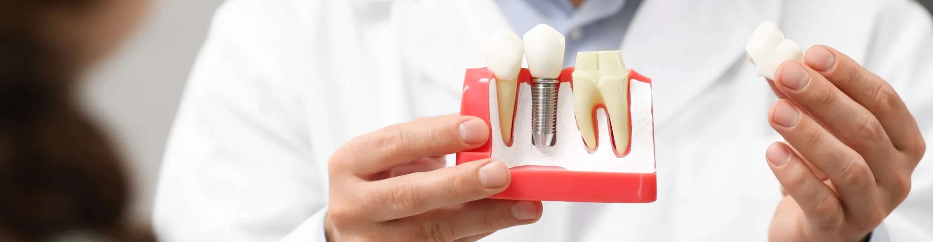 Dentist holding a dental implant model to explain candidacy and procedure to a patient.