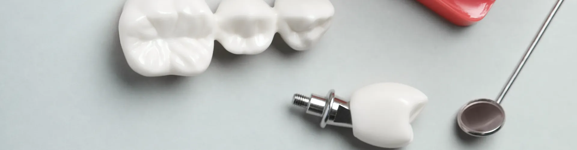 Dental implants and bridges.
