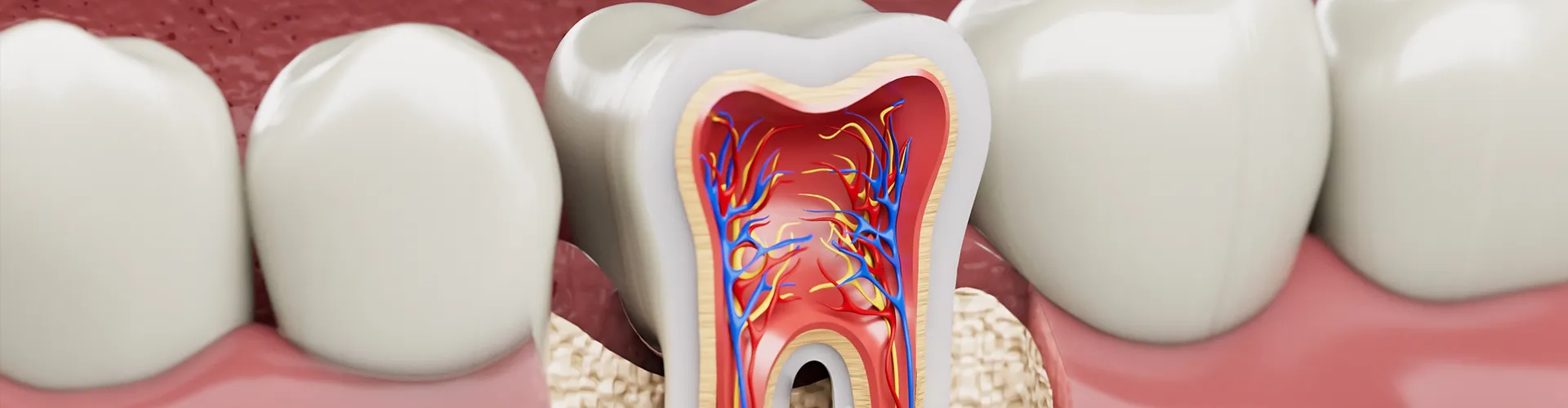 Rendering of a row of bottom teeth with one tooth showing the internal anatomy.