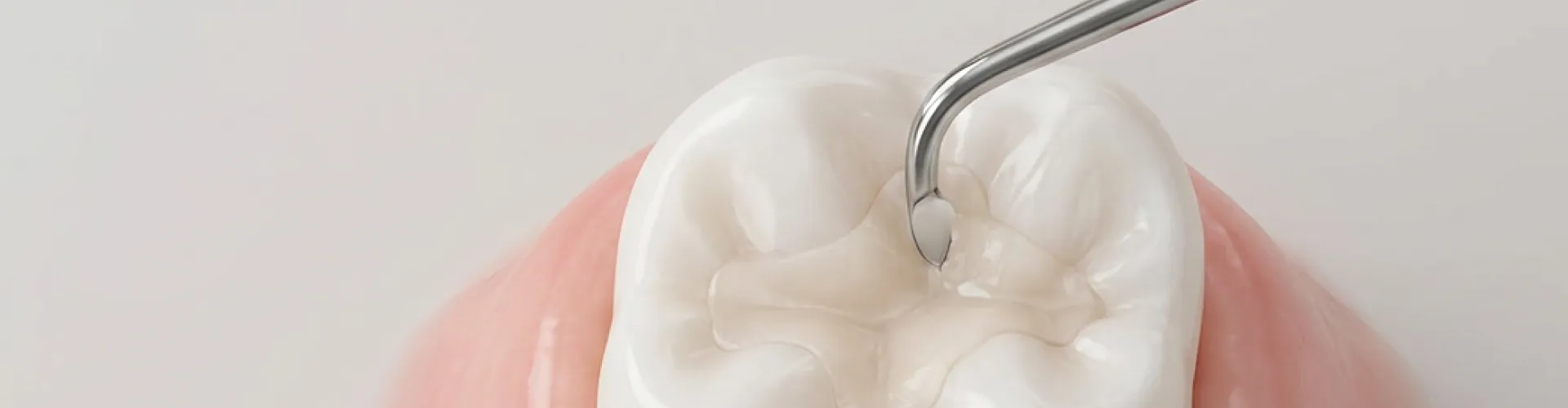 Close-up of a tooth undergoing dental bonding, with composite resin being carefully shaped to restore the tooth's natural contours.