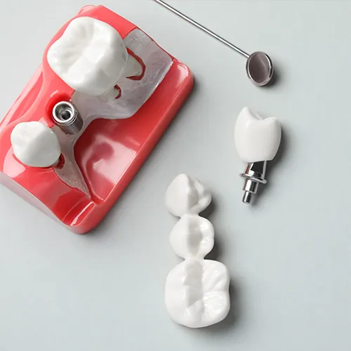 Dental implants and bridges.
