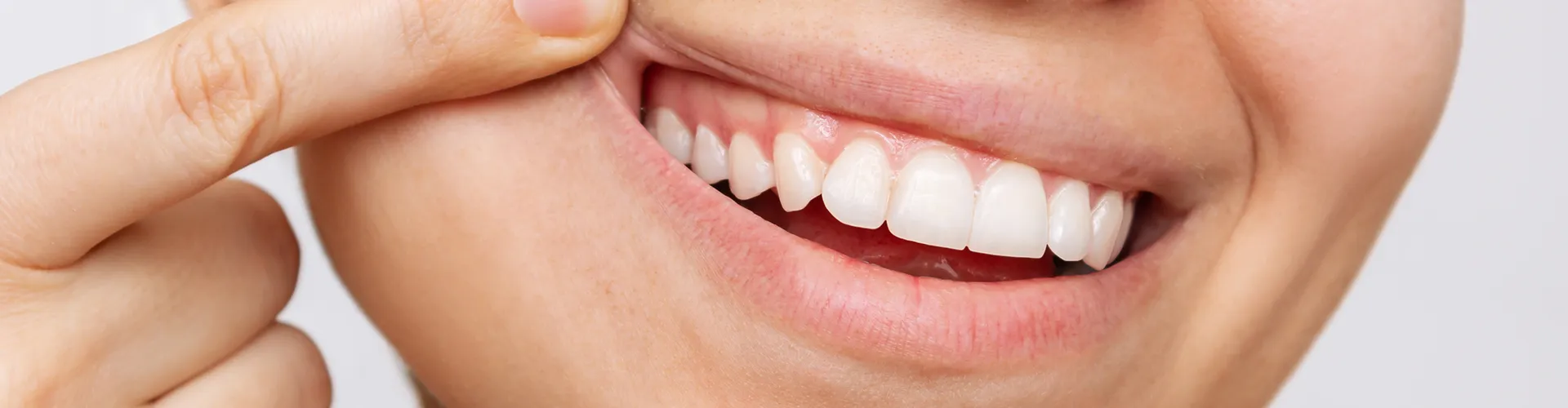 Woman lifting upper lip to reveal gums.