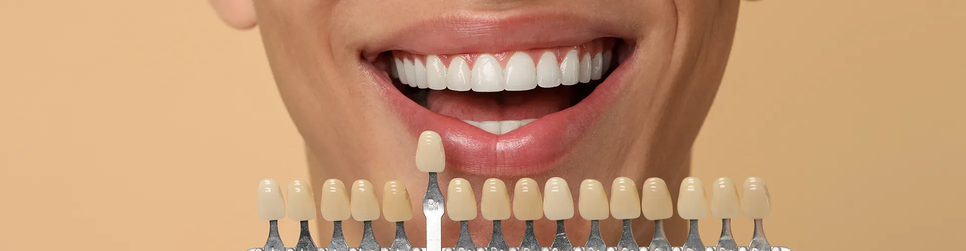 Man holding tooth shade-matching tool against his smile.