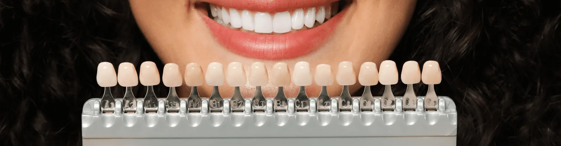 Woman holding a tooth shade-matching tool in front of her smile.