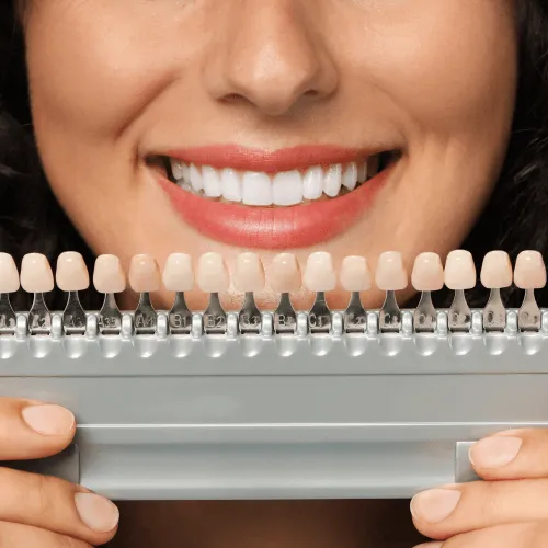 Woman holding a tooth shade-matching tool in front of her smile.