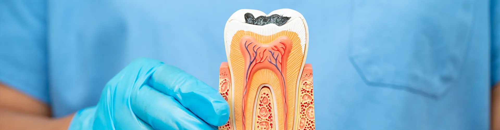 Gloved hands holding tooth model showing the anatomy.