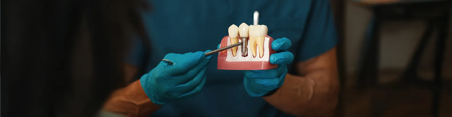 Gloved hands holding a model with an implant between two teeth.