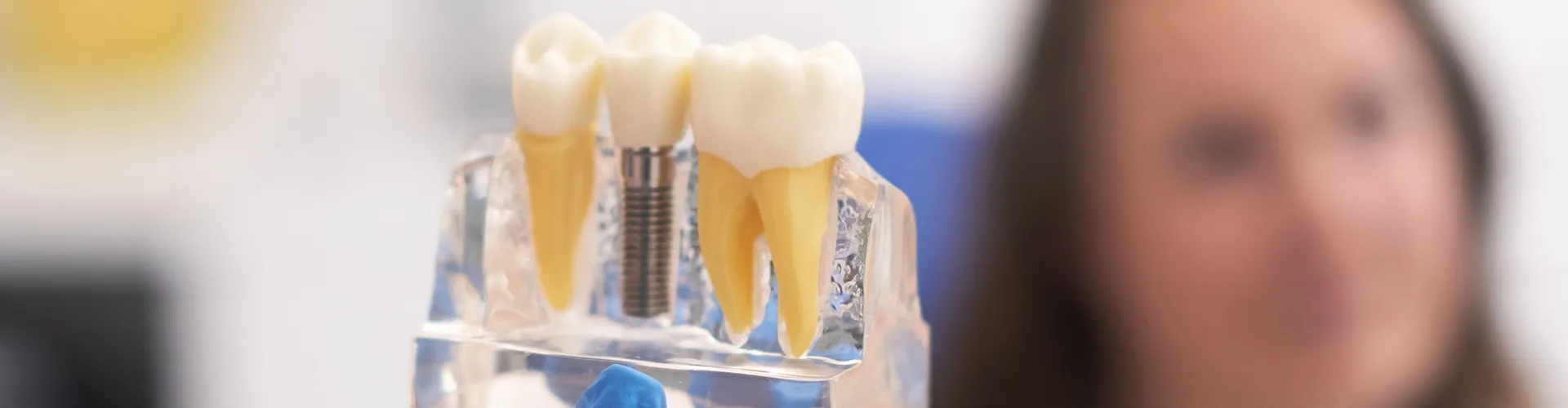 Gloved hand holding implant model in front of woman.