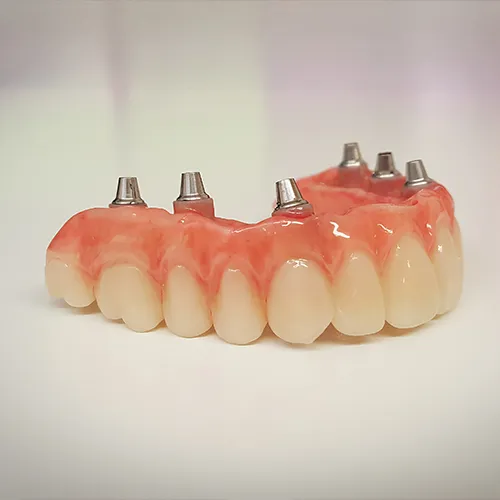 upper denture