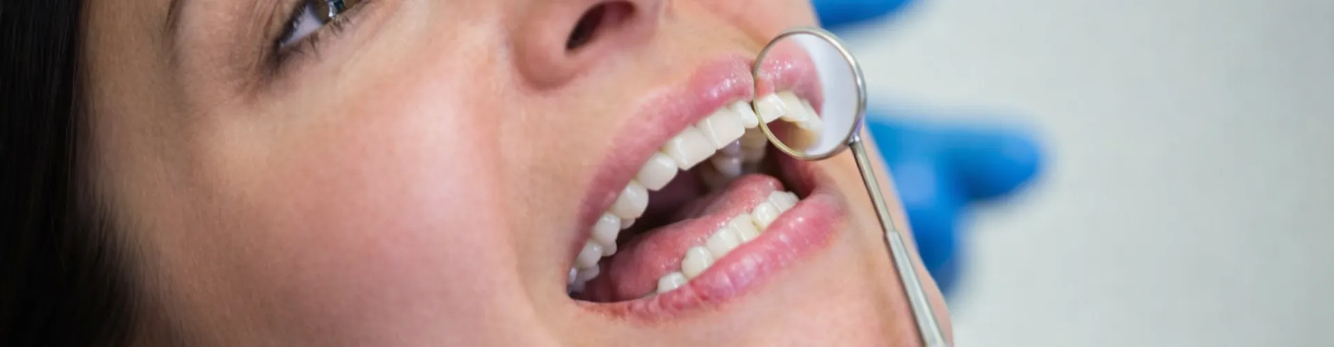 Gloved hands holding dental mirror against woman's teeth.